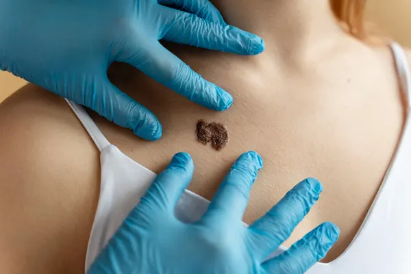 Entender cómo inicia el cáncer de piel es el primer paso para proteger tu salud y actuar de forma temprana. En esta guía descubrirás señales, causas y factores que debes...